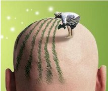 种植的头发牢固吗