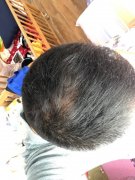 多亏了增发纤维我才又感受到了重视