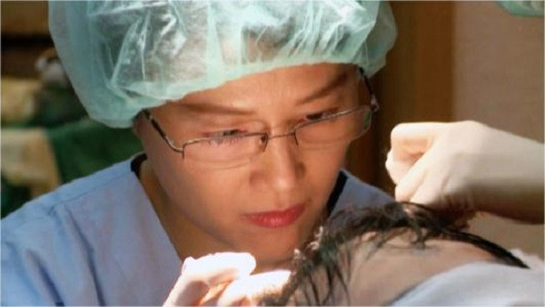 植发的特点有哪些