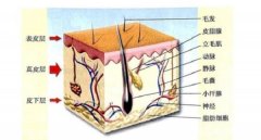 毛囊萎缩和毛囊闭合有什么区别