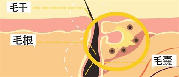 什么因素会影响到毛囊的成活率