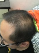 增发纤维真的是我的救星