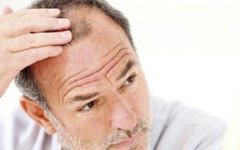 怎么分辨脱发类型