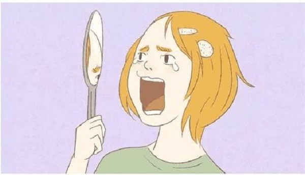 疤痕植发的成功率