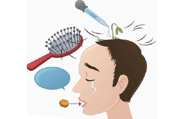 现在的植发可靠吗