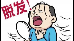 脱发前期的预兆
