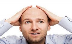 严重脱发应该要怎么办