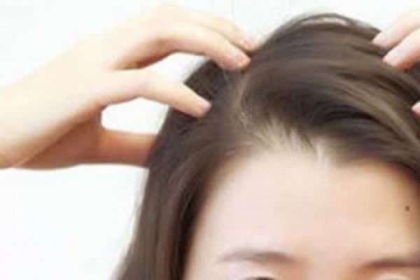 植发以后多久会长出来头发