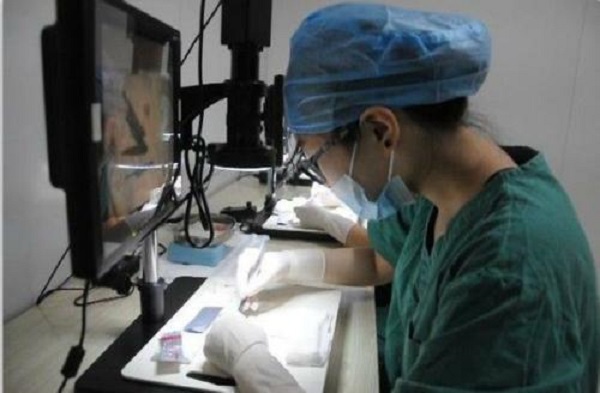 植发手术有没有风险