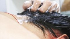 洗头时脱发严重是什么原因