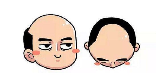 植发后多久头发才能长出来