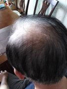 增发纤维让我找回了自信