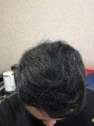 增发纤维拯救了我