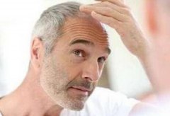 怎么才能让白头发变黑