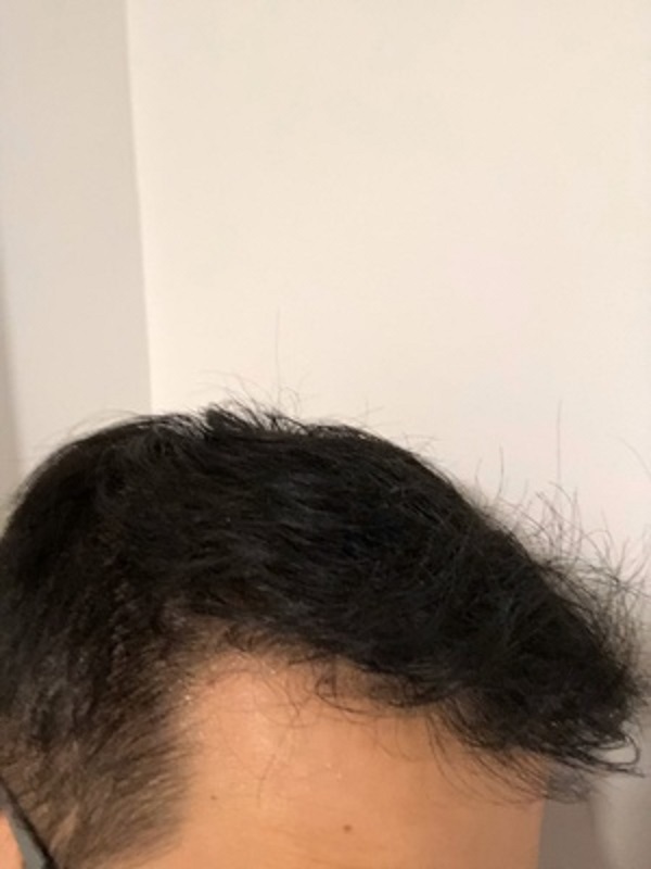 增发纤维恢复了我的形象