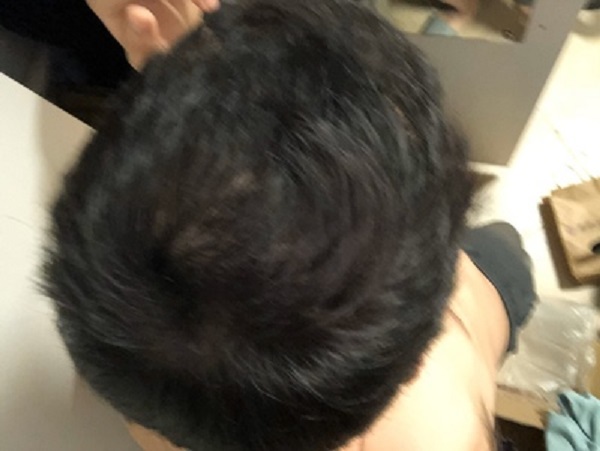 增发纤维恢复了我的形象