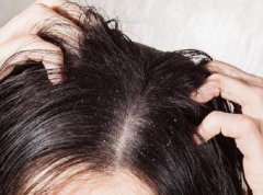 扣头皮会有什么危害