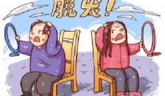 常见的脱发类型有哪些