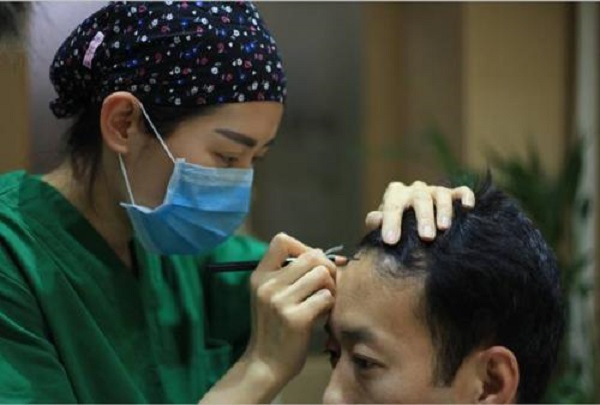 为什么植发后原生发还会脱落