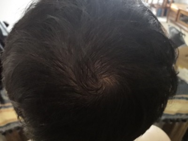 绝望的拐角处遇到了增发纤维