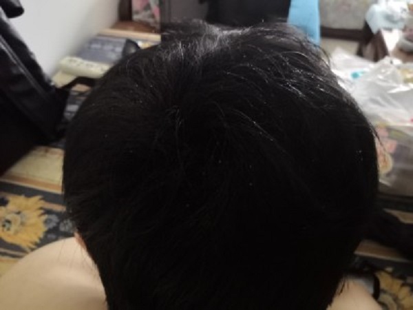 绝望的拐角处遇到了增发纤维