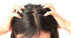 硫磺皂真的可以治疗脂溢性脱发吗