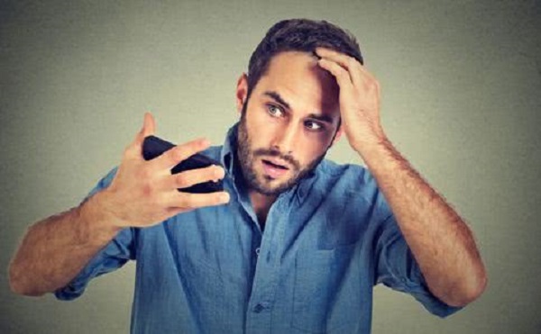 男性应该怎么治疗脱发
