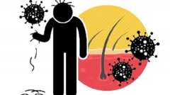 脱发与身体有什么关系