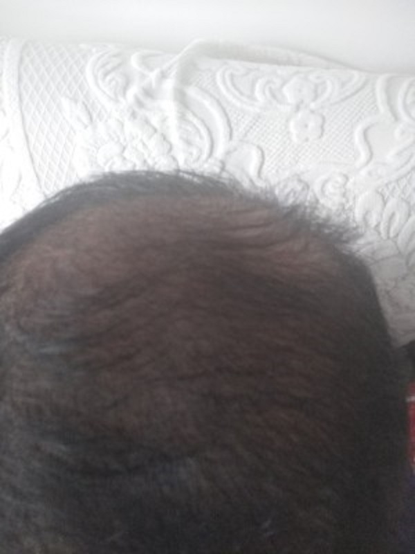 增发纤维让我能够重拾自信