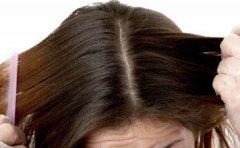 头皮红痒是怎么回事