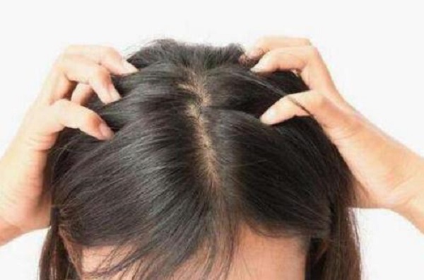 头皮红痒是怎么回事