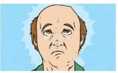 突发性脱发是什么原因导致的