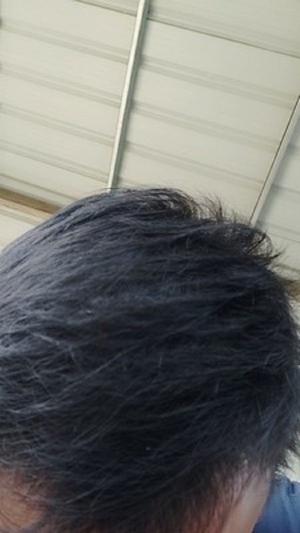 感谢增发纤维让我脱离脱发的魔爪