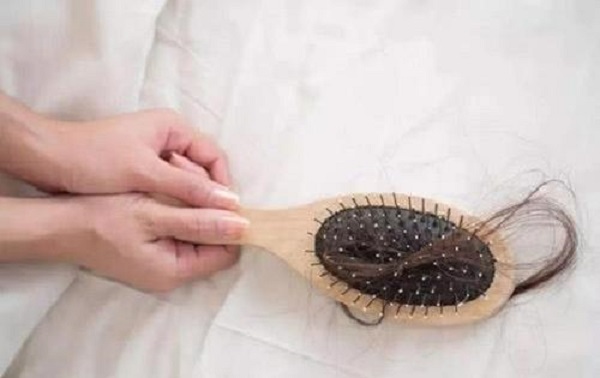 治疗脱发的较好时机是什么时候