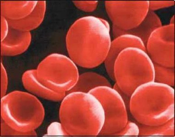 长期贫血会不会导致脱发呢