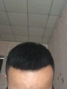 增发纤维助我脱离痛苦