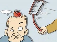 脱发会不会传染