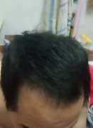 增发纤维让我不再自卑