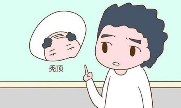 植发应该要注意哪些问题