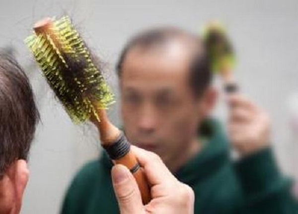 什么原因导致了鬓角脱发