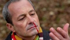 血热真的会导致脱发吗