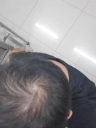 增发纤维帮助我恢复自信