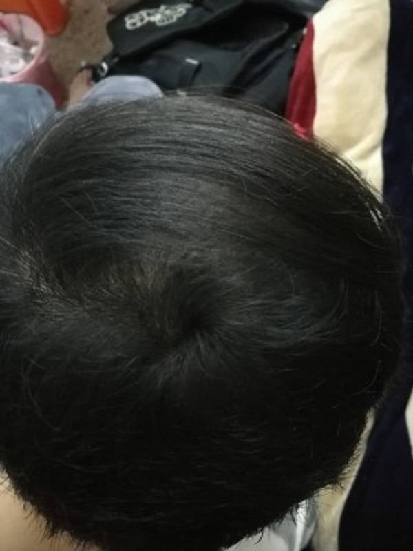 增发纤维把我拯救了出来