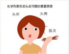 防脱发洗发水真的能防脱发吗