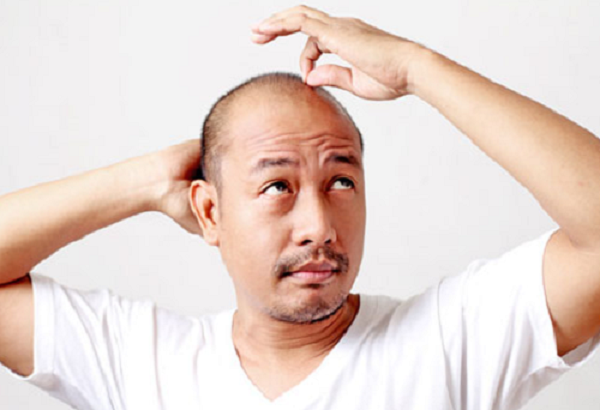 地中海能恢复吗