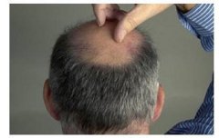 地中海能恢复吗