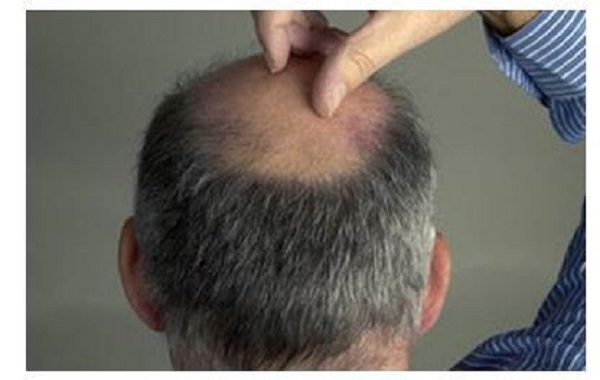 地中海能恢复吗