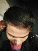 感谢遇到了增发纤维