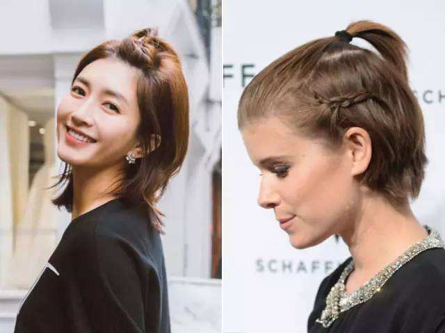 为什么你会得脂溢性脱发?——脂溢性脱发是什么