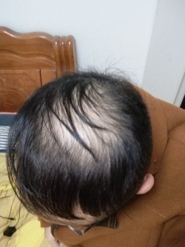 增发纤维使用后的效果很让人惊喜